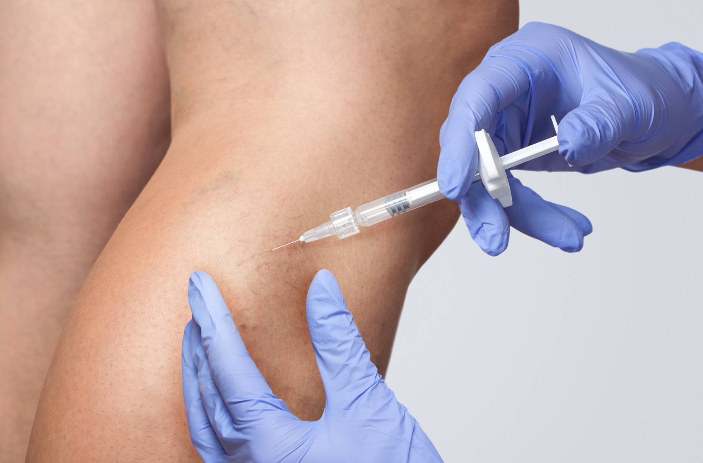 PEIM: Guia definitivo para secagem de vasinhos com glicose em Uberlândia