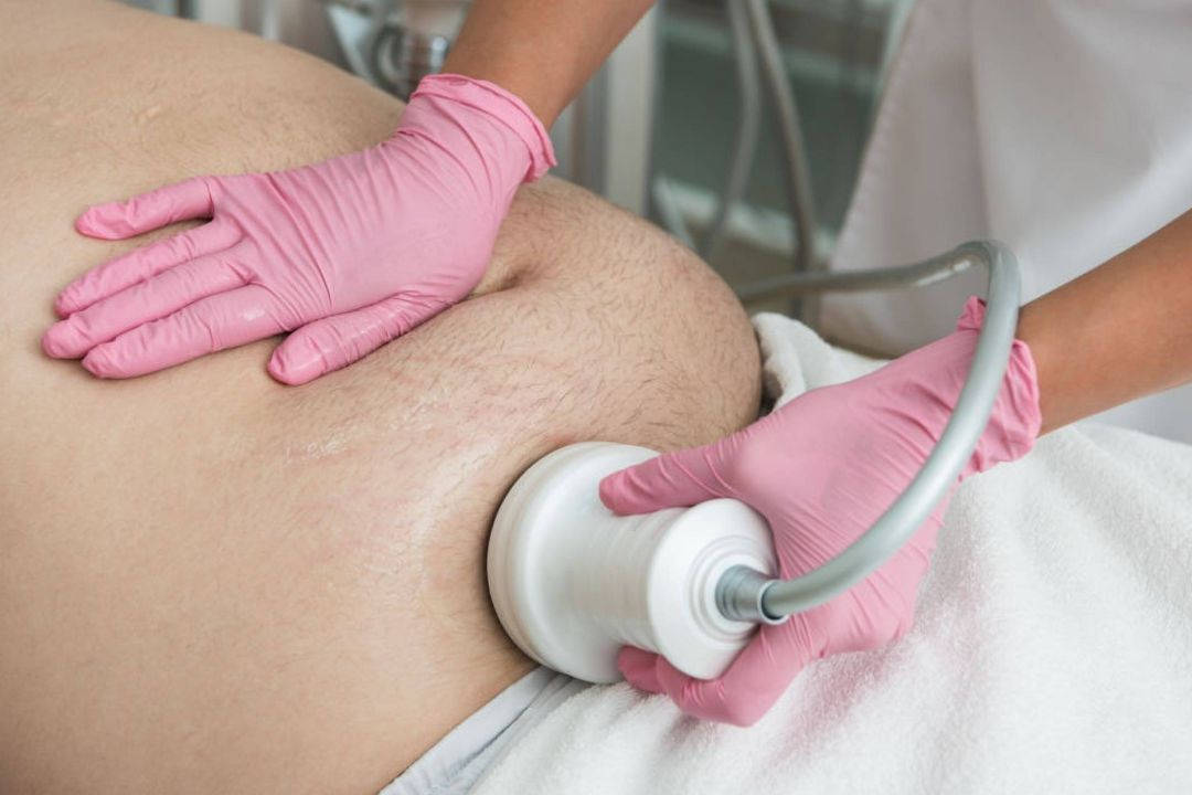 Tratamento de Lipocavitação em Uberlândia