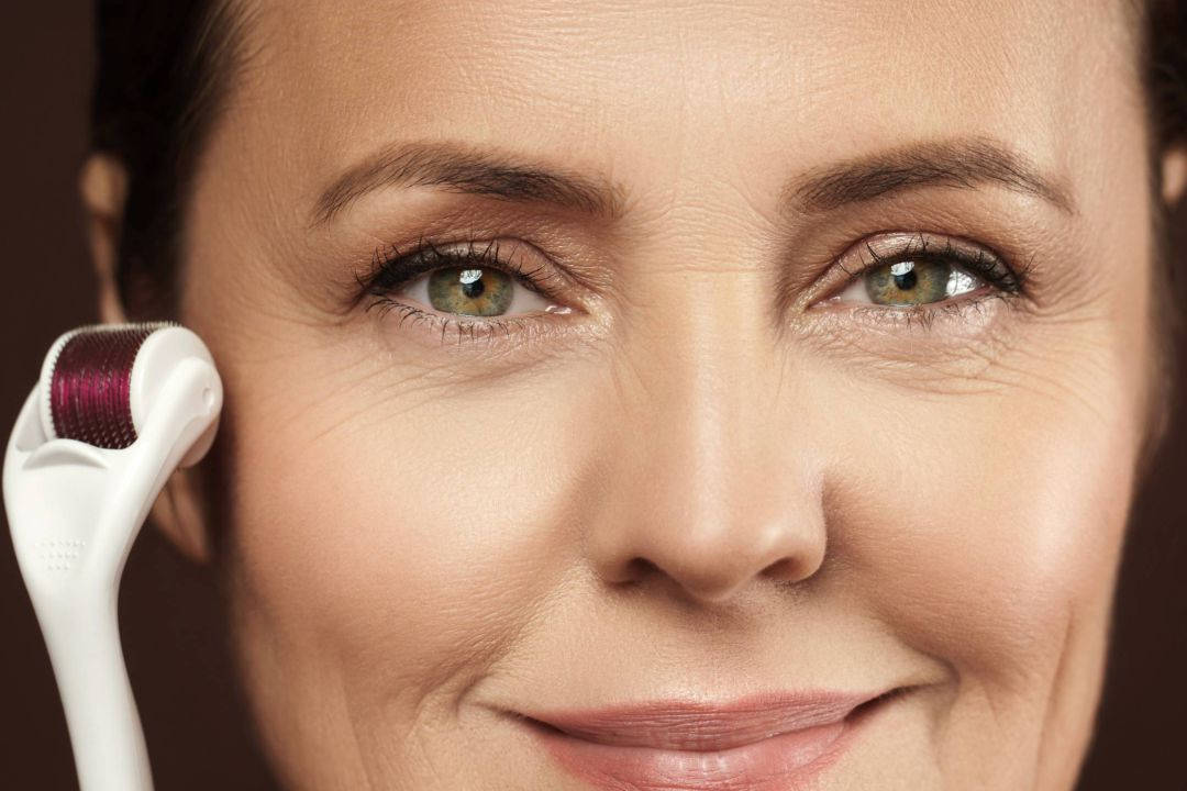 Tratamento de Microagulhamento em Uberlândia - NeoSkin